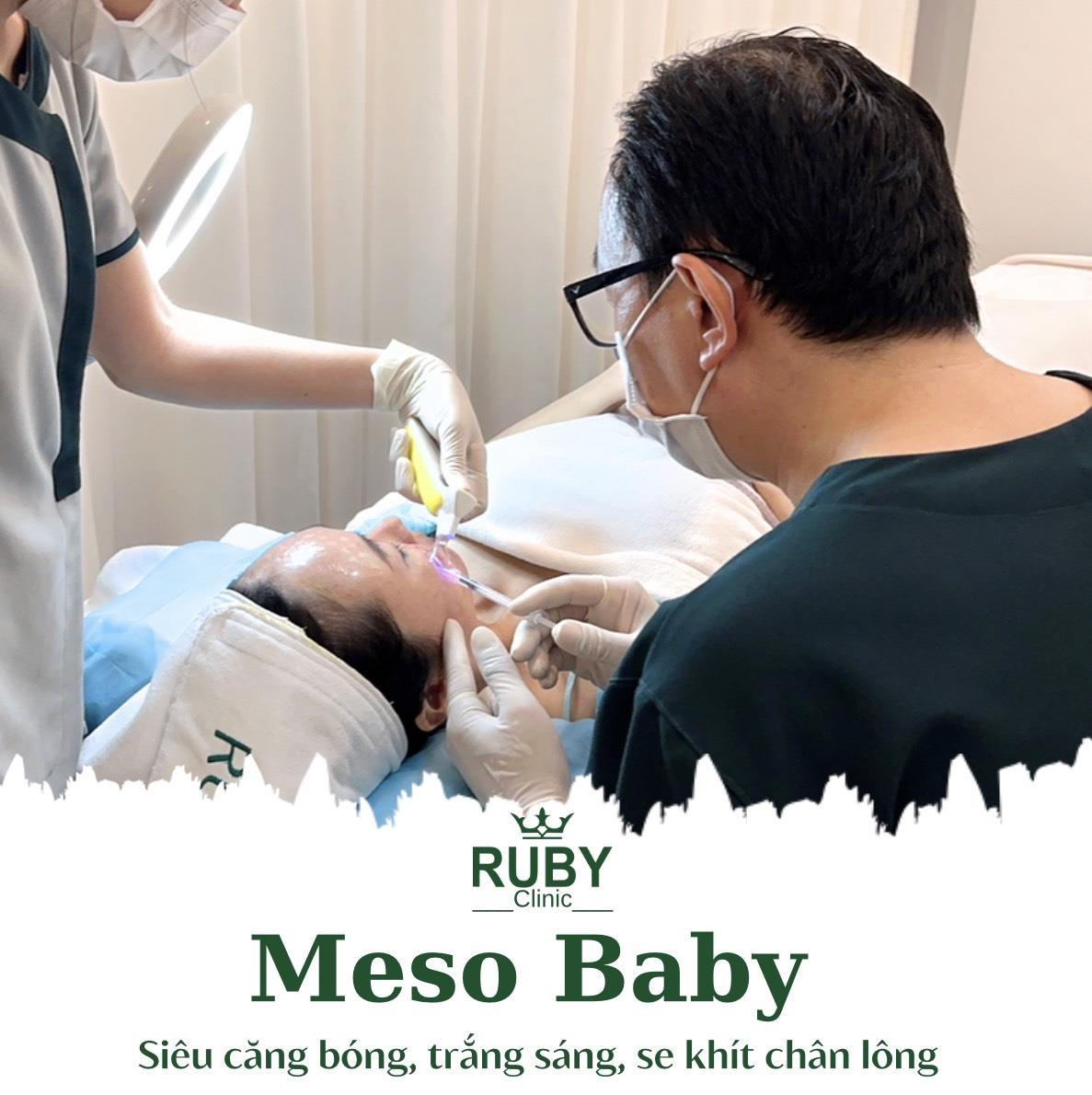 DV Meso Baby ( exosome pure Tb cuống rốn )