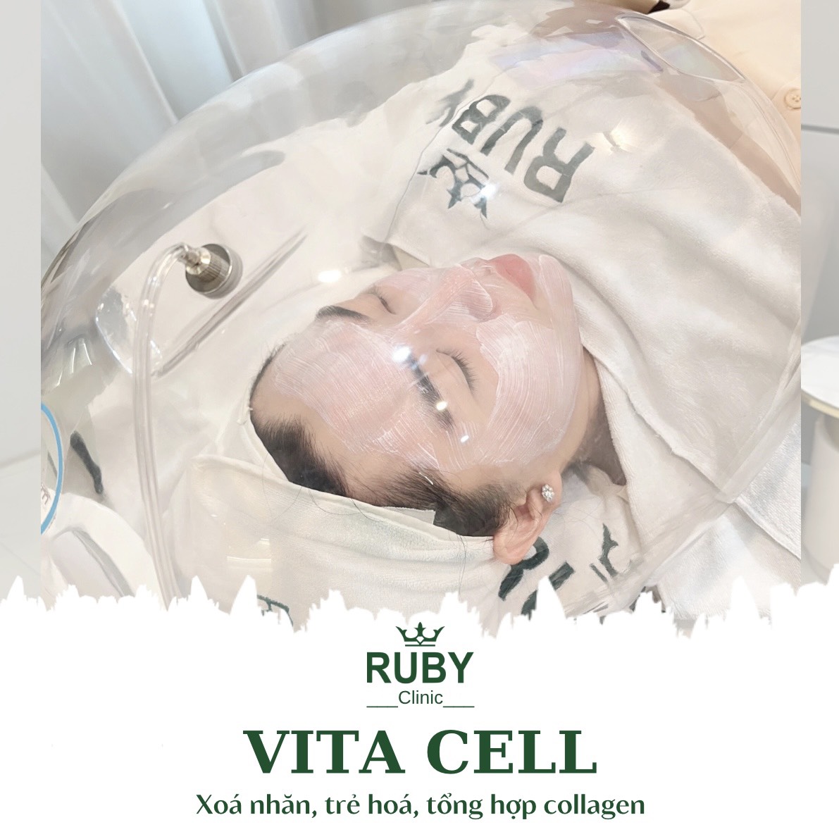 DV Vita Cell